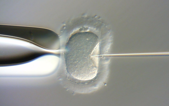 顕微授精（Intracytoplasmic sperm ingection： ICSI）